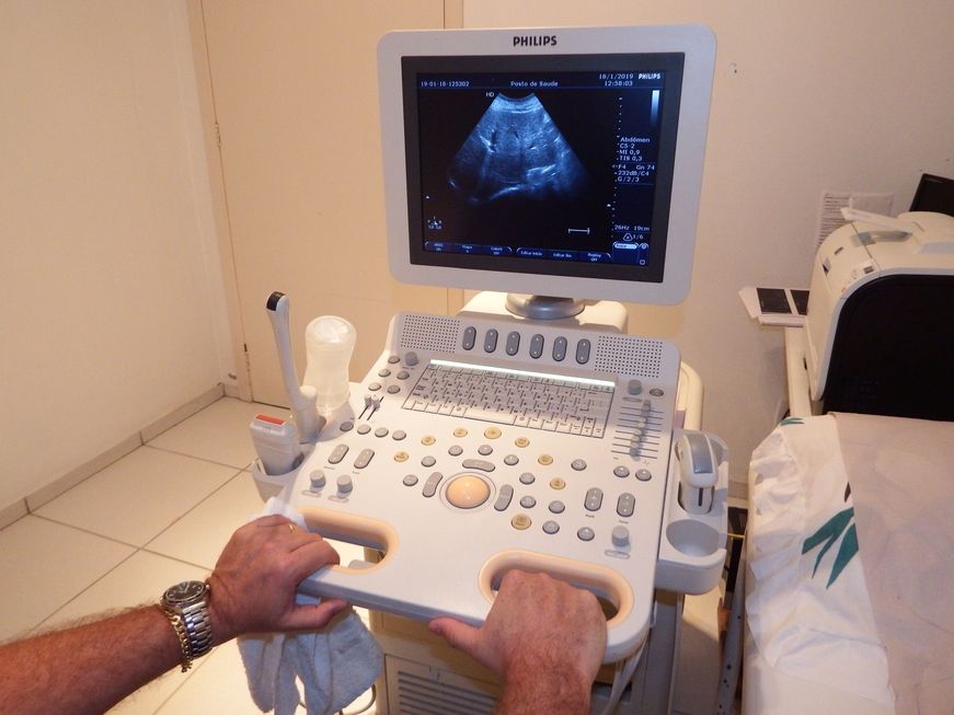 Mutirão de ultrassons vai realizar mais de 5 mil exames neste mês